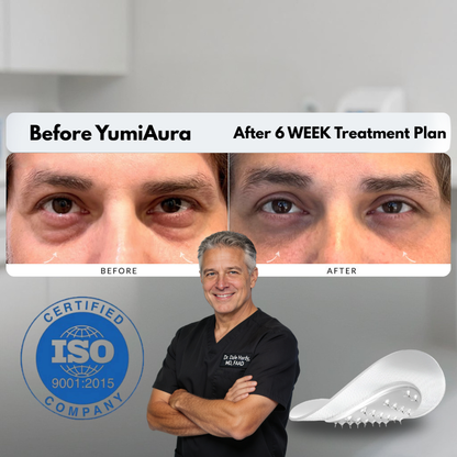 Serum Infused Microneedle Patches