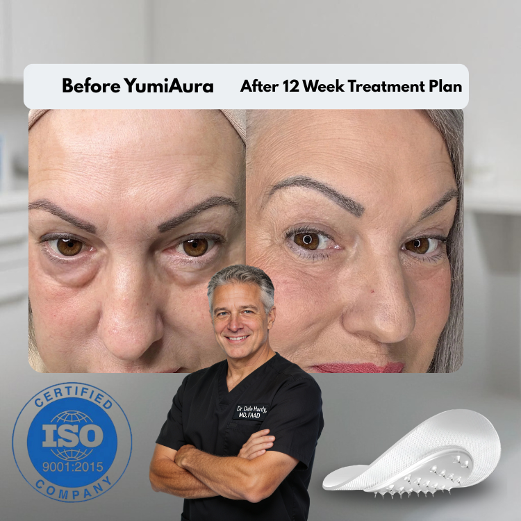 Serum Infused Microneedle Patches