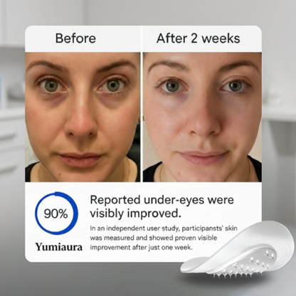 Serum Infused Microneedle Patches