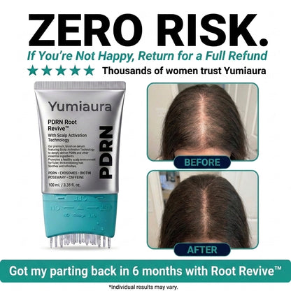 PDRN Root Revive™