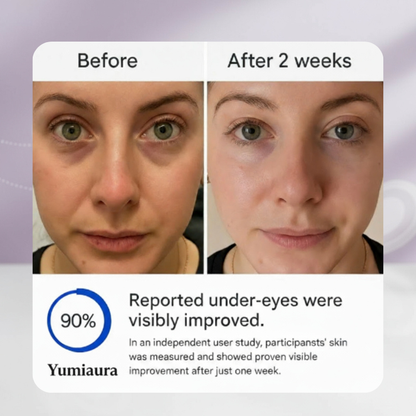 Serum Infused Microneedle Patches